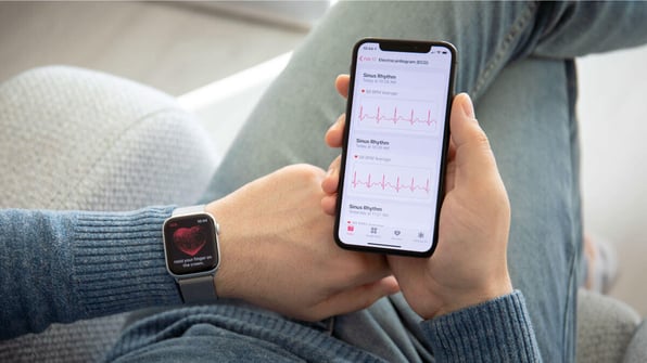 A man holding a phone connected to his wearable smart watch measuring his sinus rhythm showcasing a use of IoMT. | Scilife