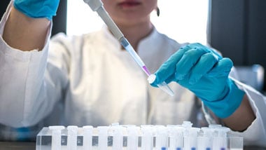 Learn-how-to-optimize-your-trials